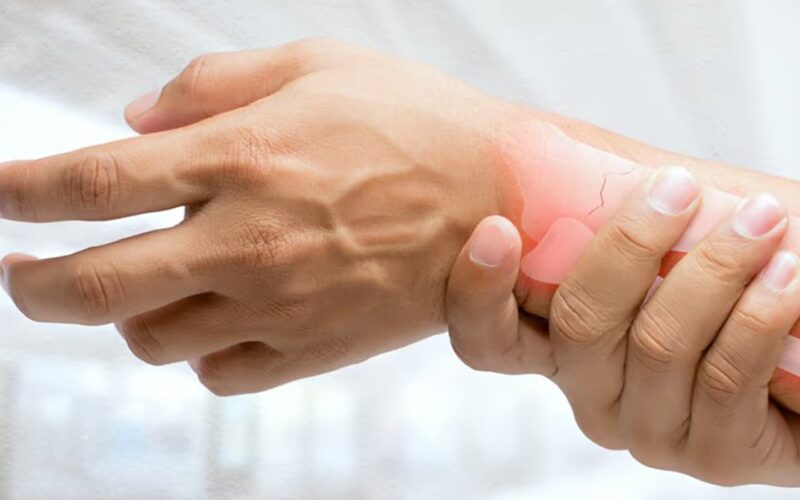 Artrite Reumatoide: O Que É e Como Tratamos