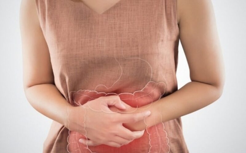 Síndrome do Intestino Irritável (SII)