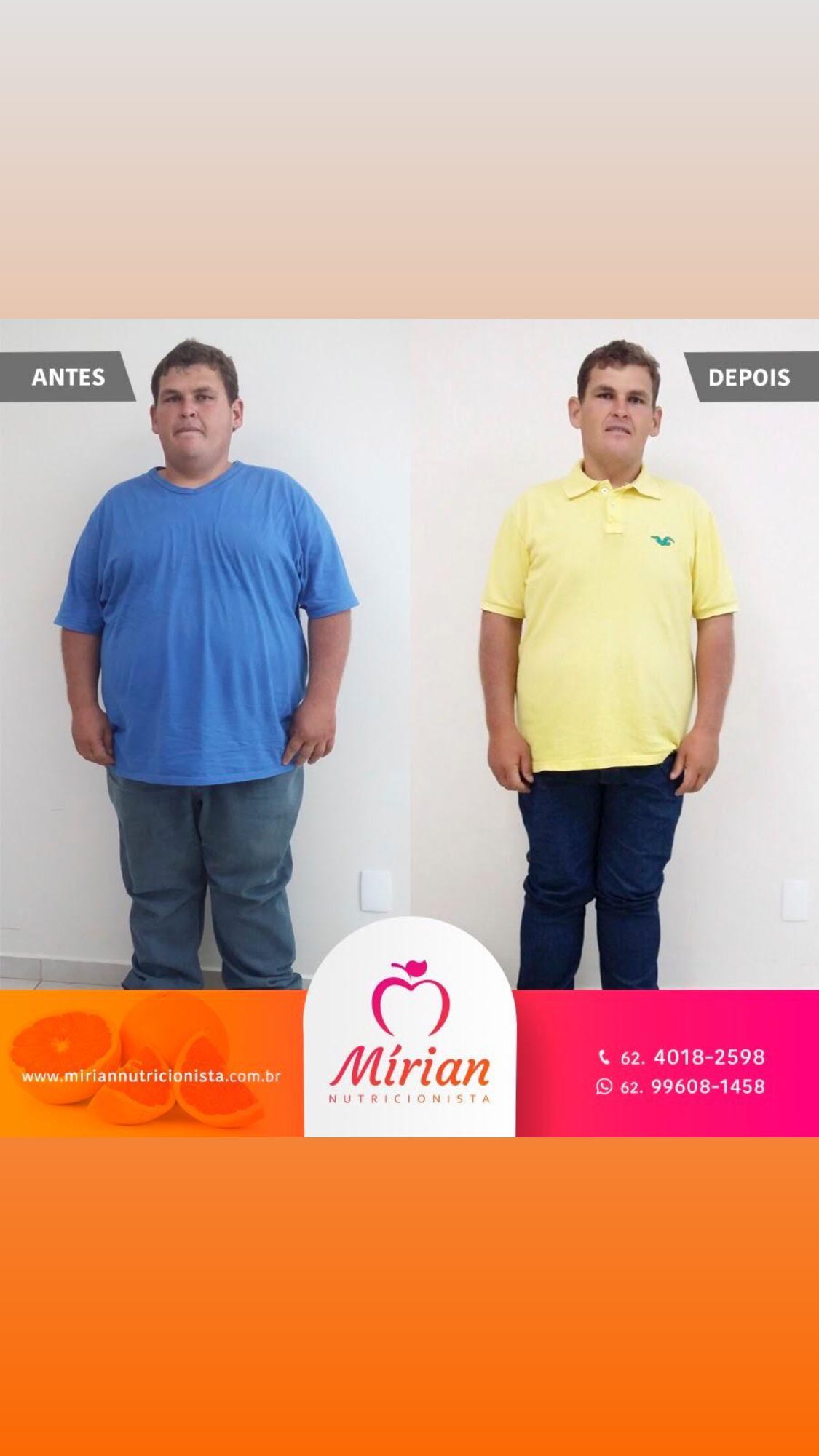 Antes e depois — paciente