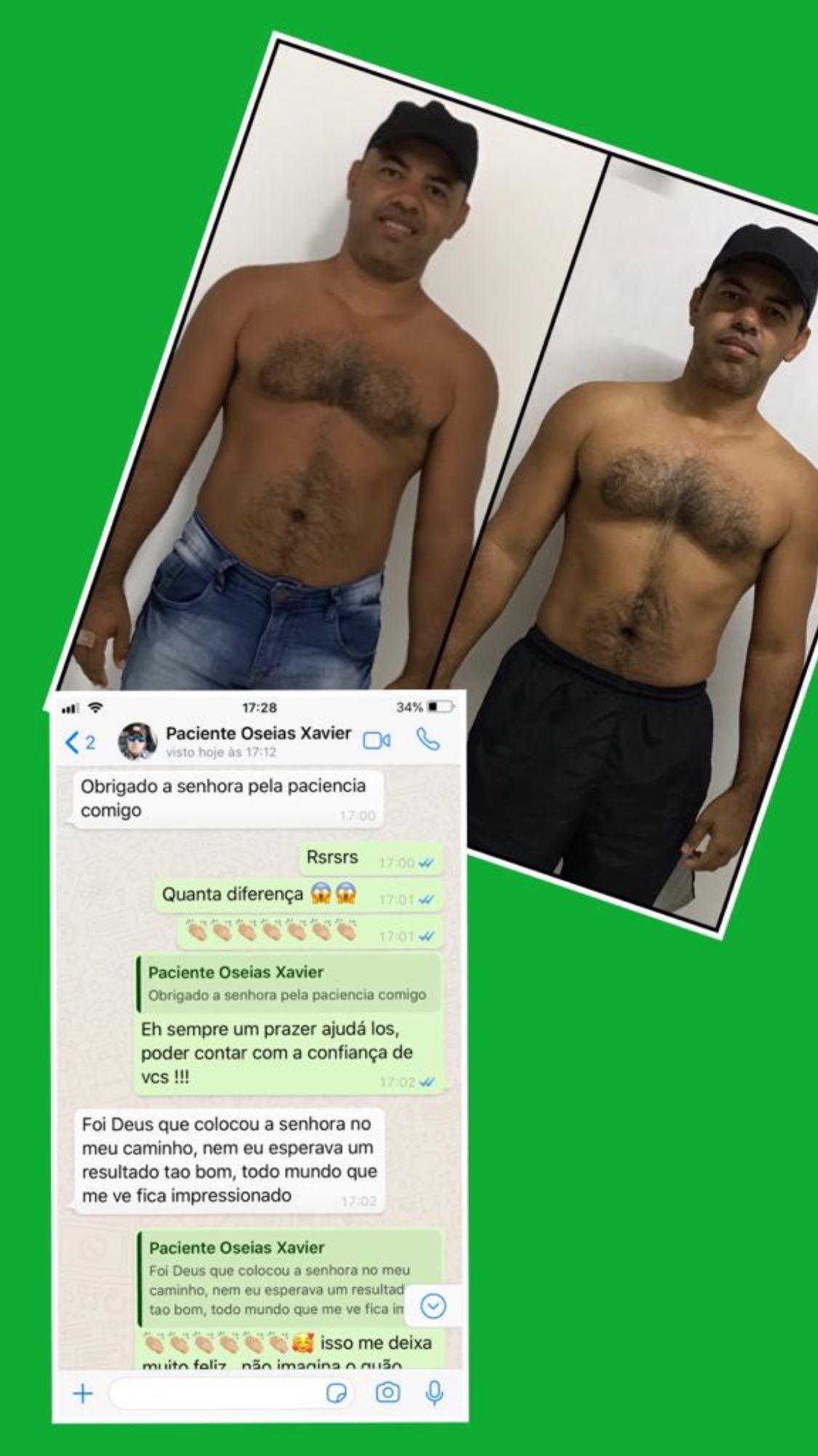 Antes e depois — paciente