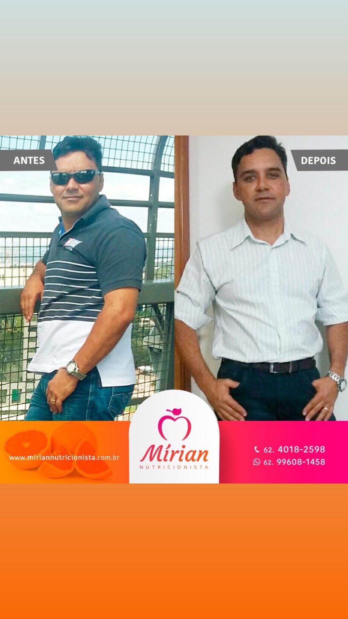 Antes e depois — paciente
