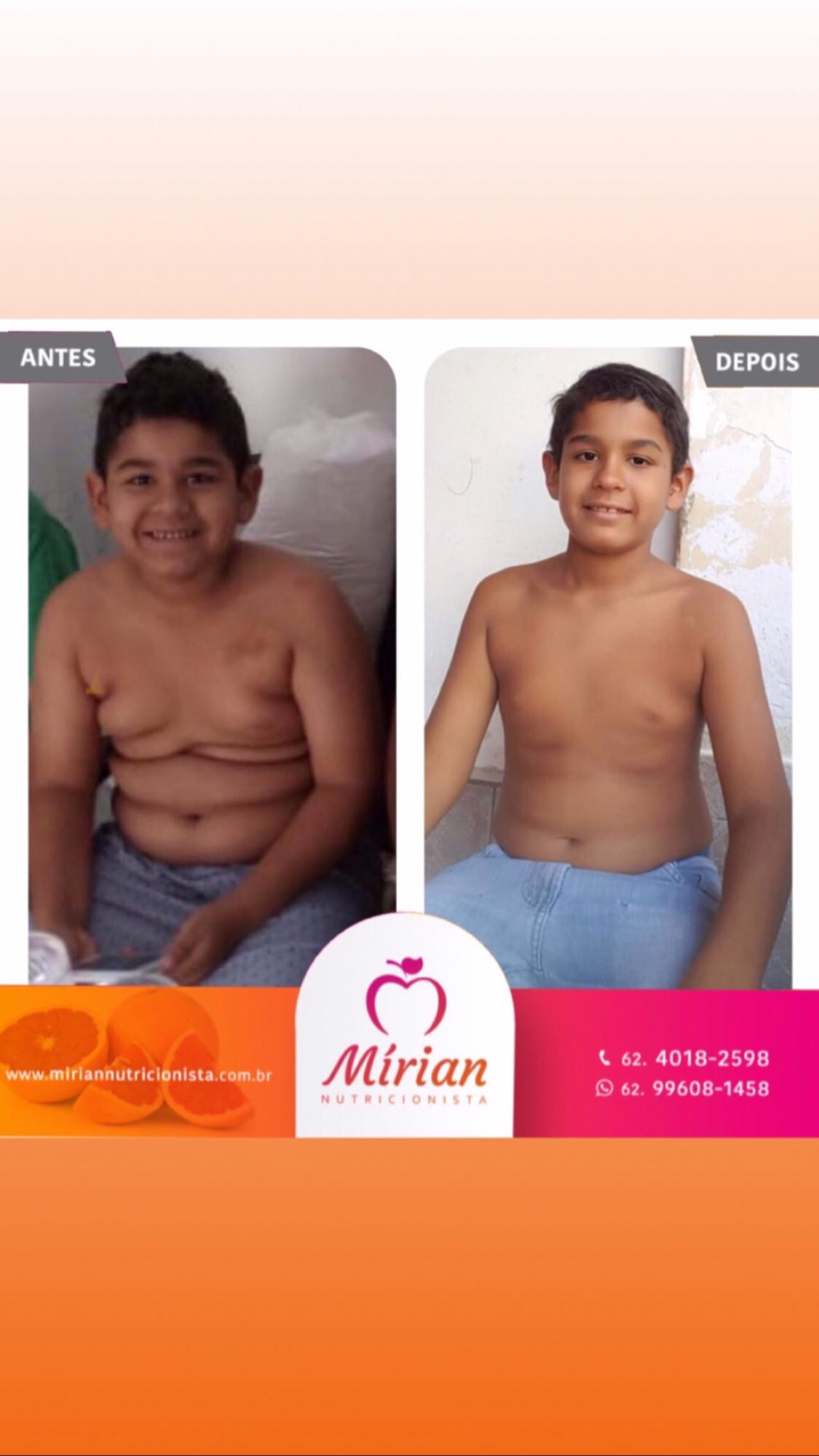 Antes e depois — paciente