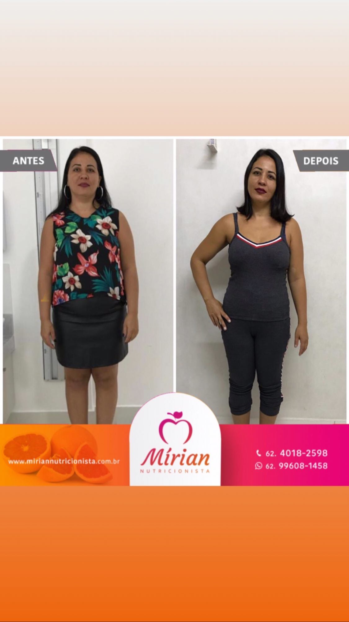Antes e depois — paciente