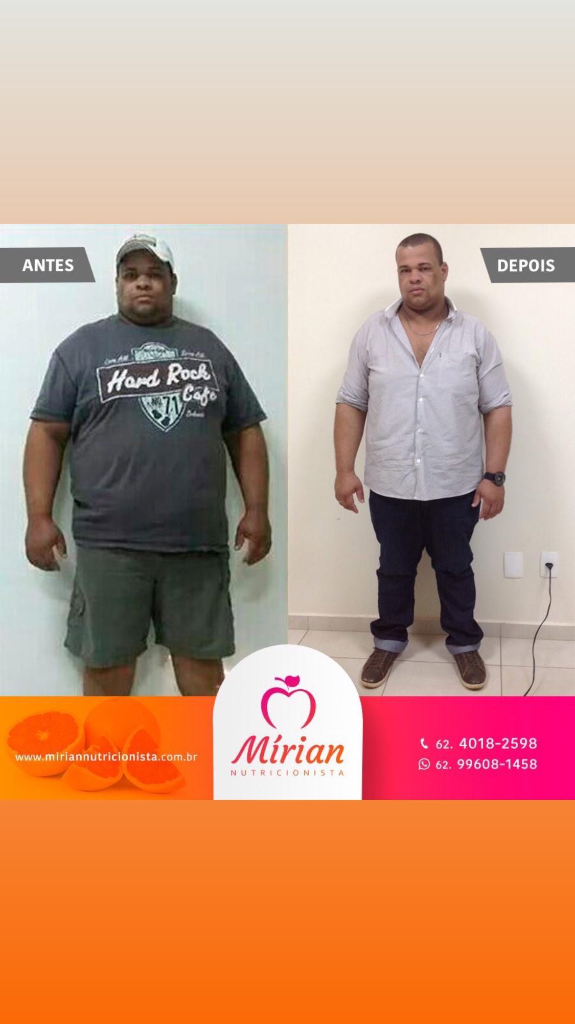 Antes e depois — paciente