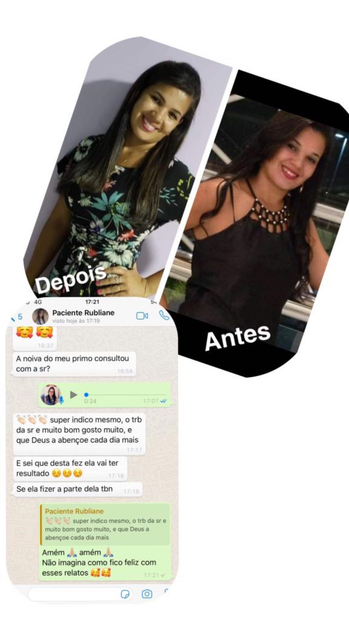 Antes e depois — paciente
