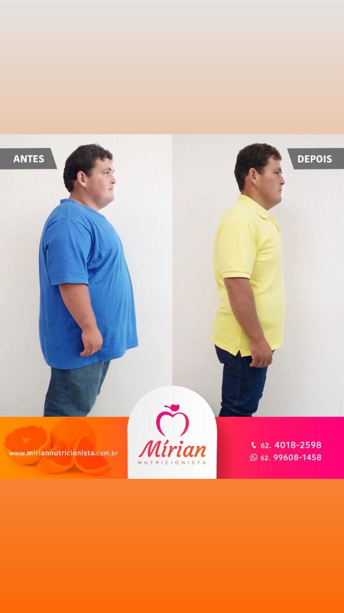 Antes e depois — paciente