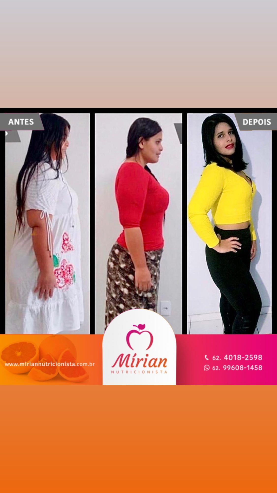 Antes e depois — paciente