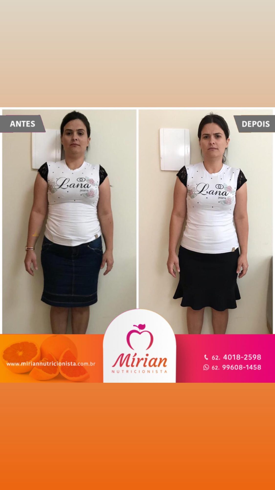 Antes e depois — paciente