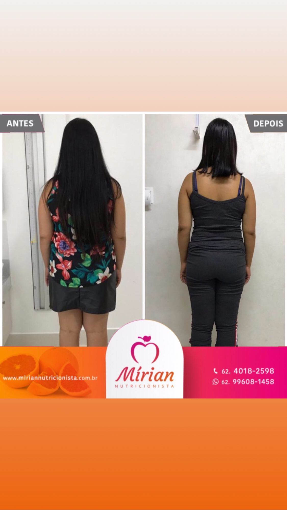 Antes e depois — paciente