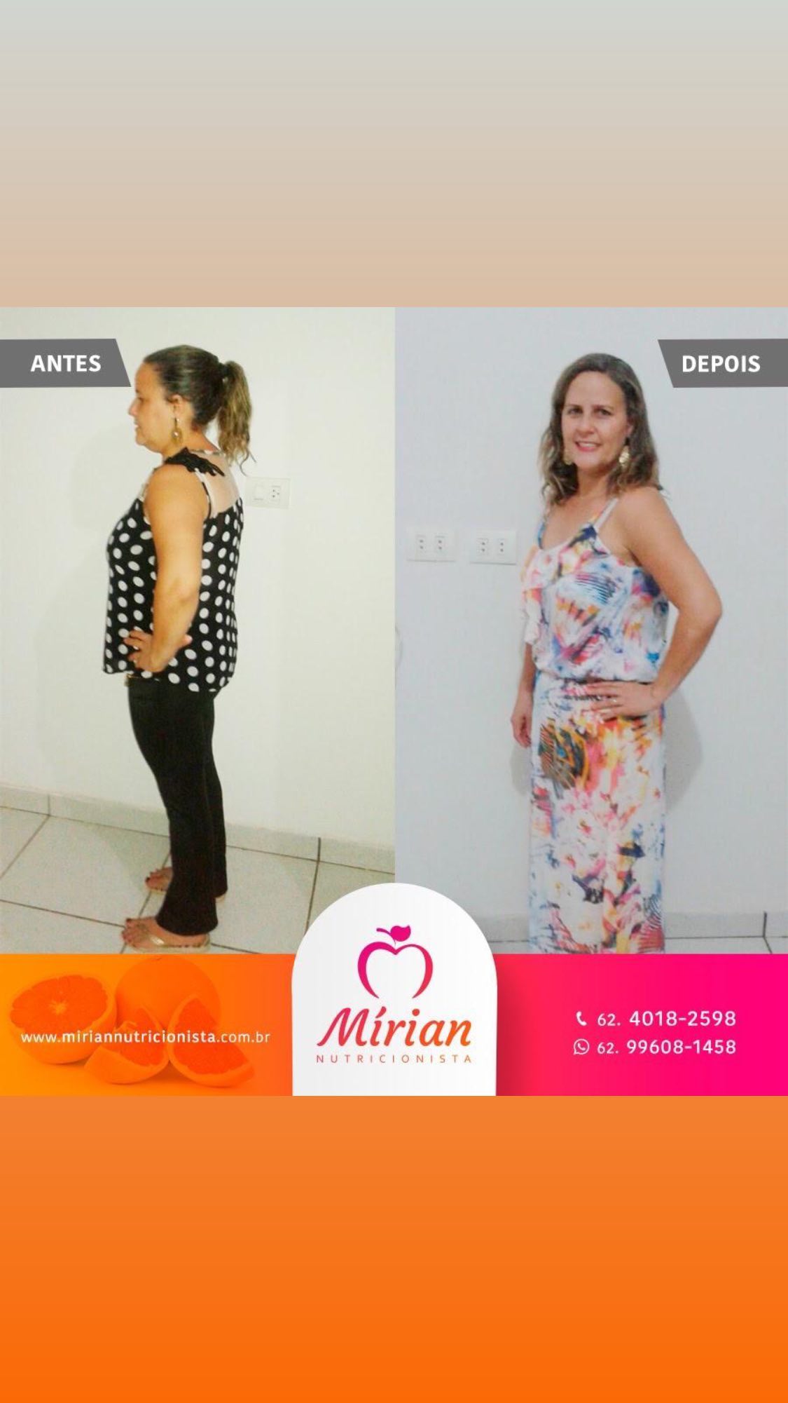 Antes e depois — paciente