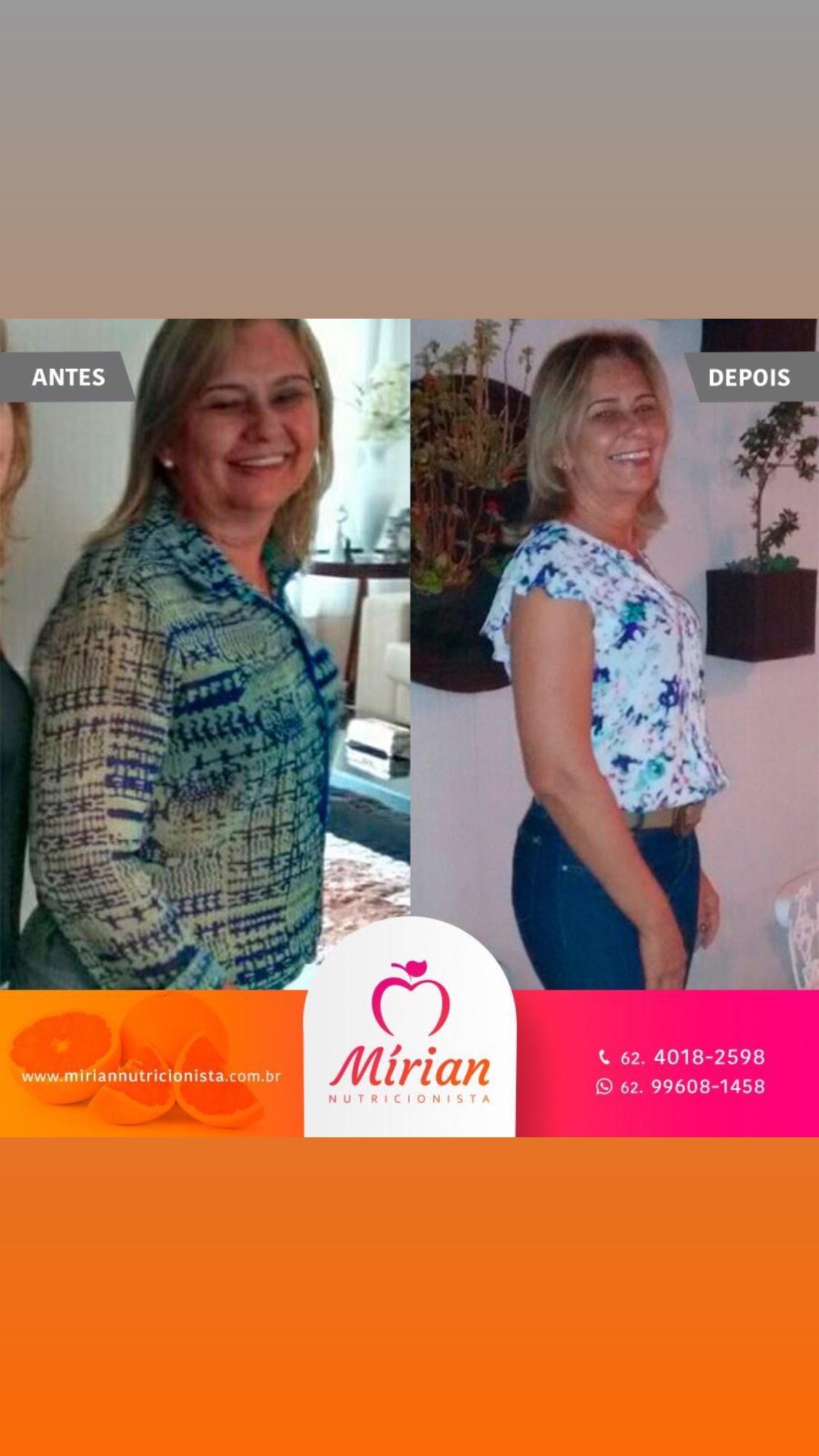 Antes e depois — paciente