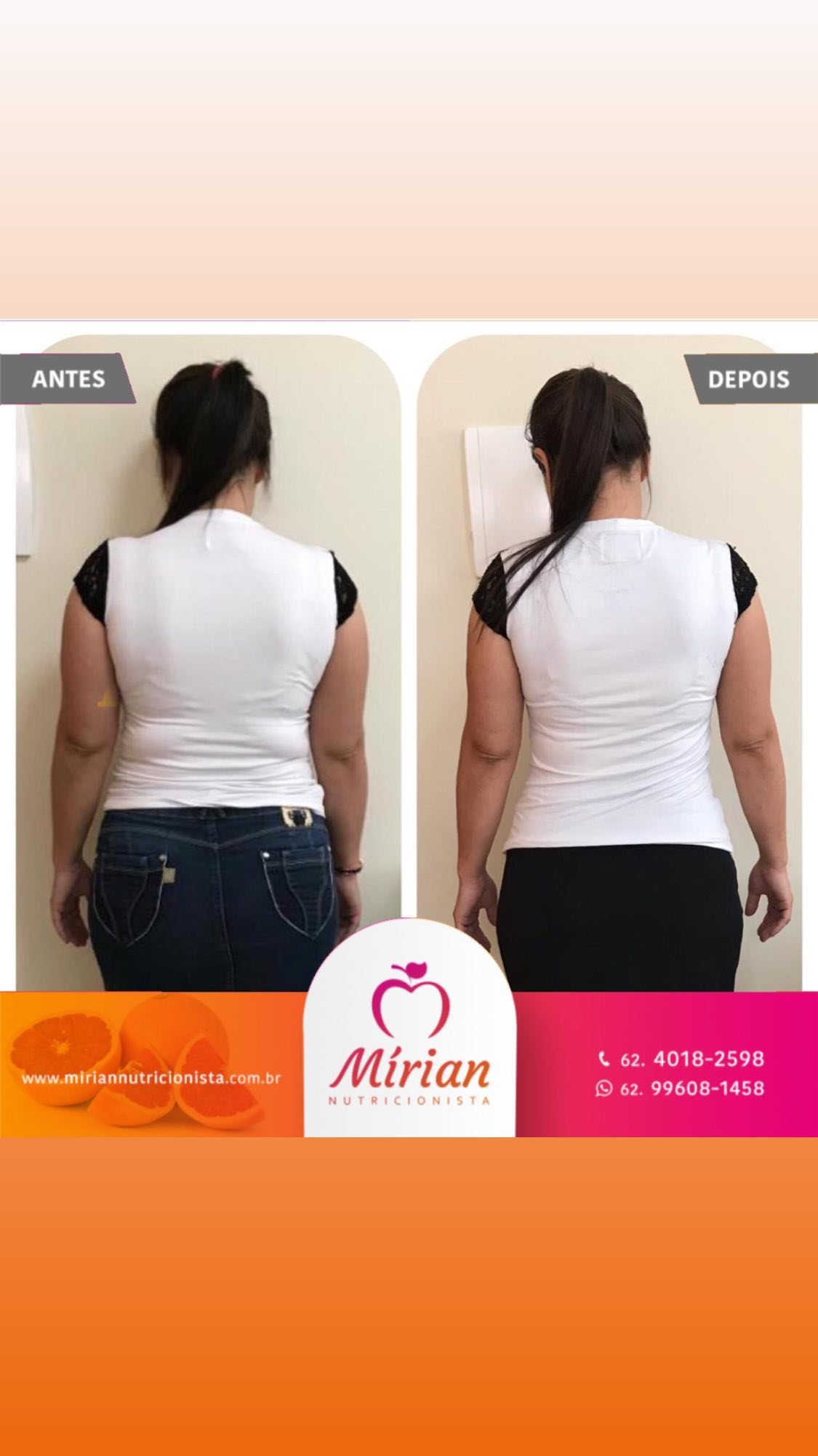 Antes e depois — paciente