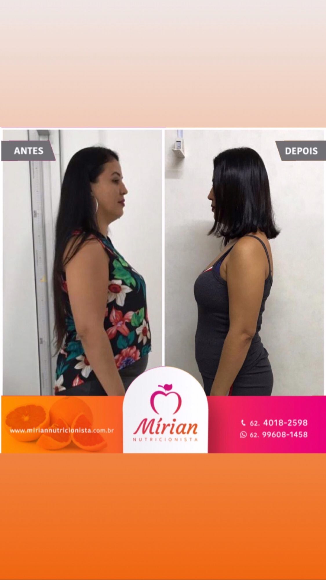 Antes e depois — paciente
