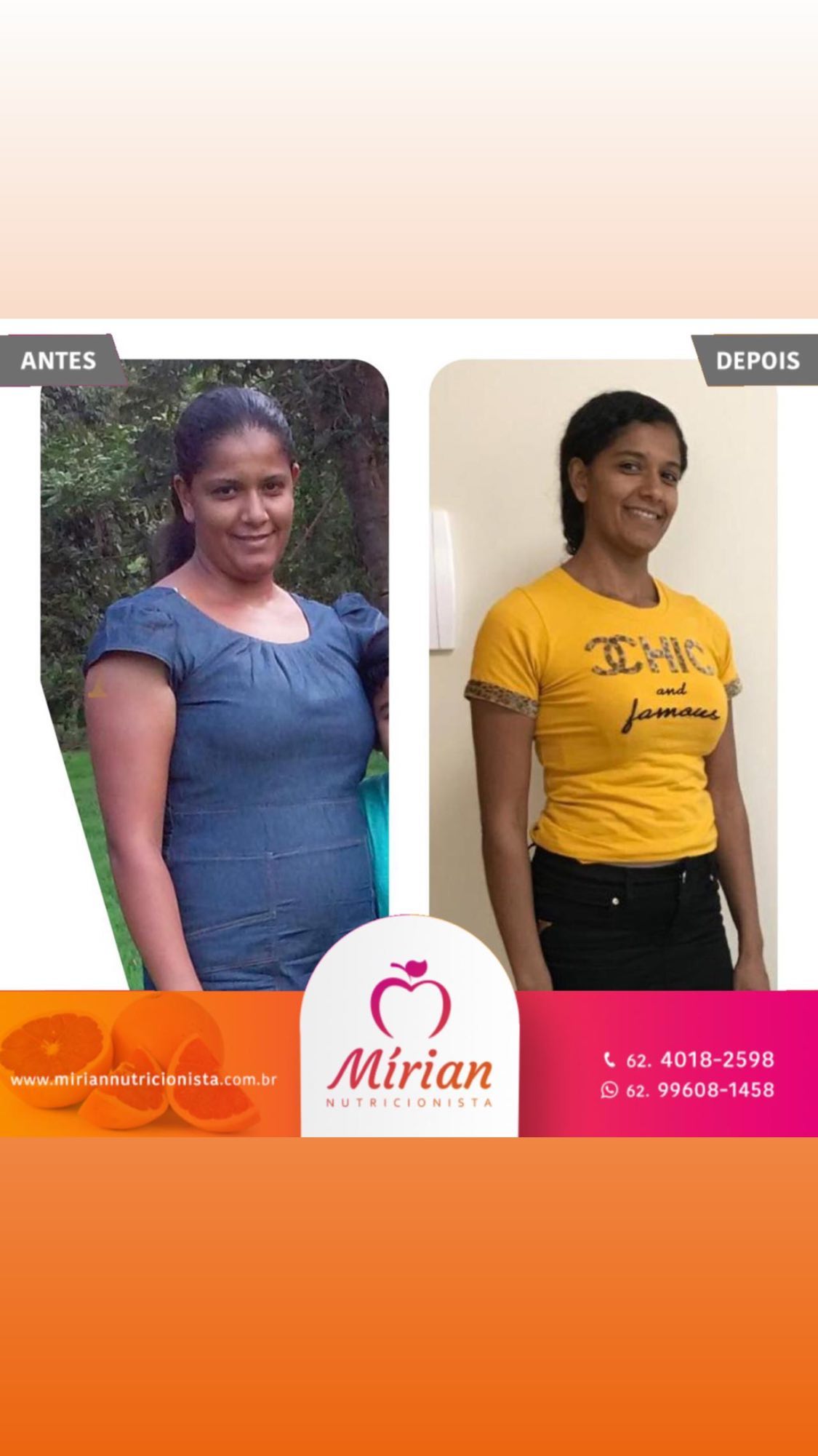 Antes e depois — paciente