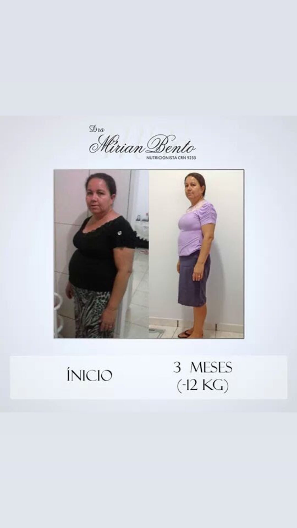 Antes e depois — paciente